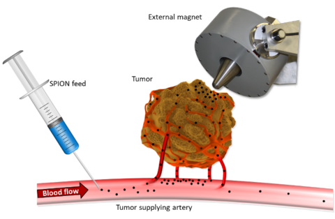 Towards entry "Targeted cancer therapy"